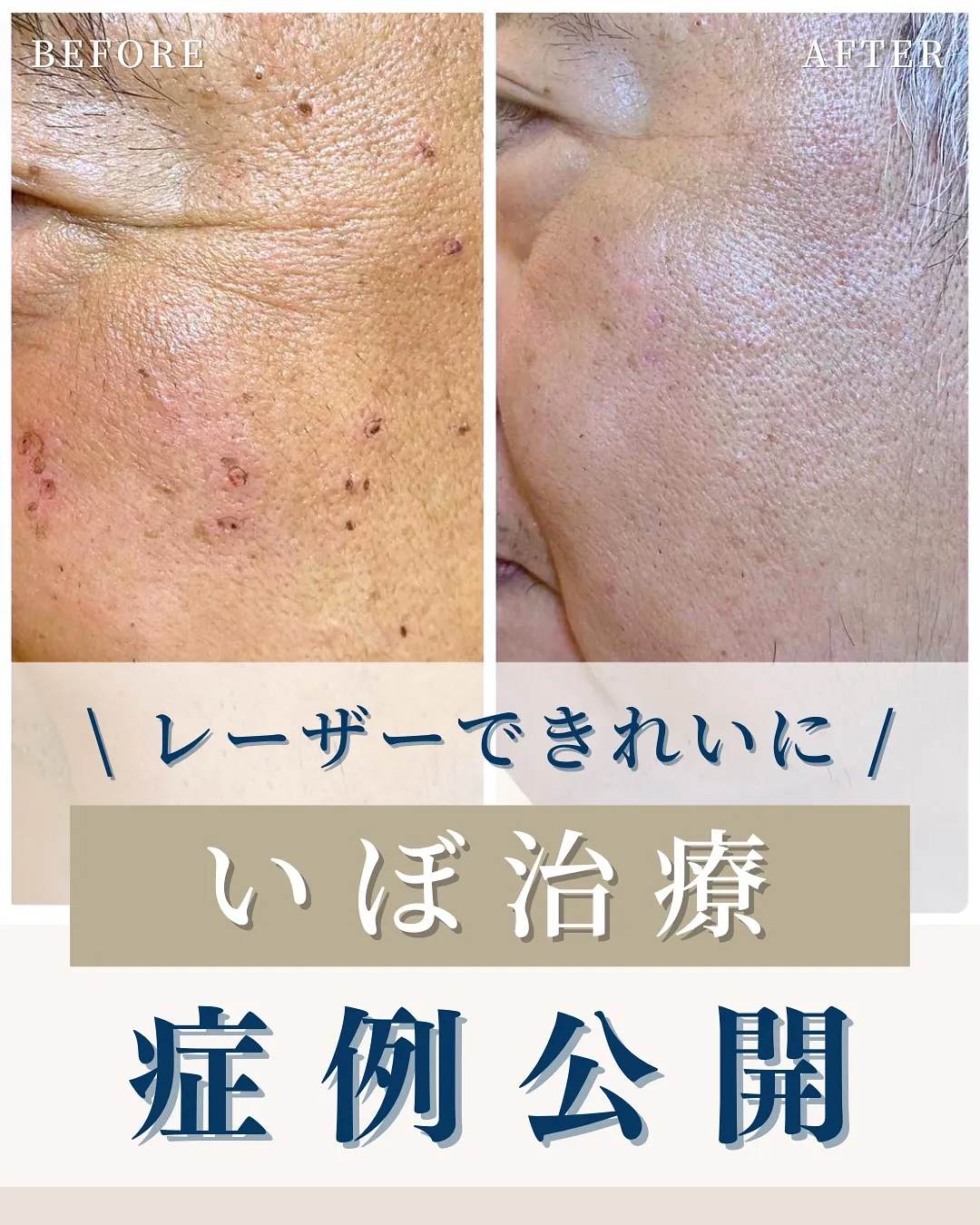 ←施術の詳細はこちらから！