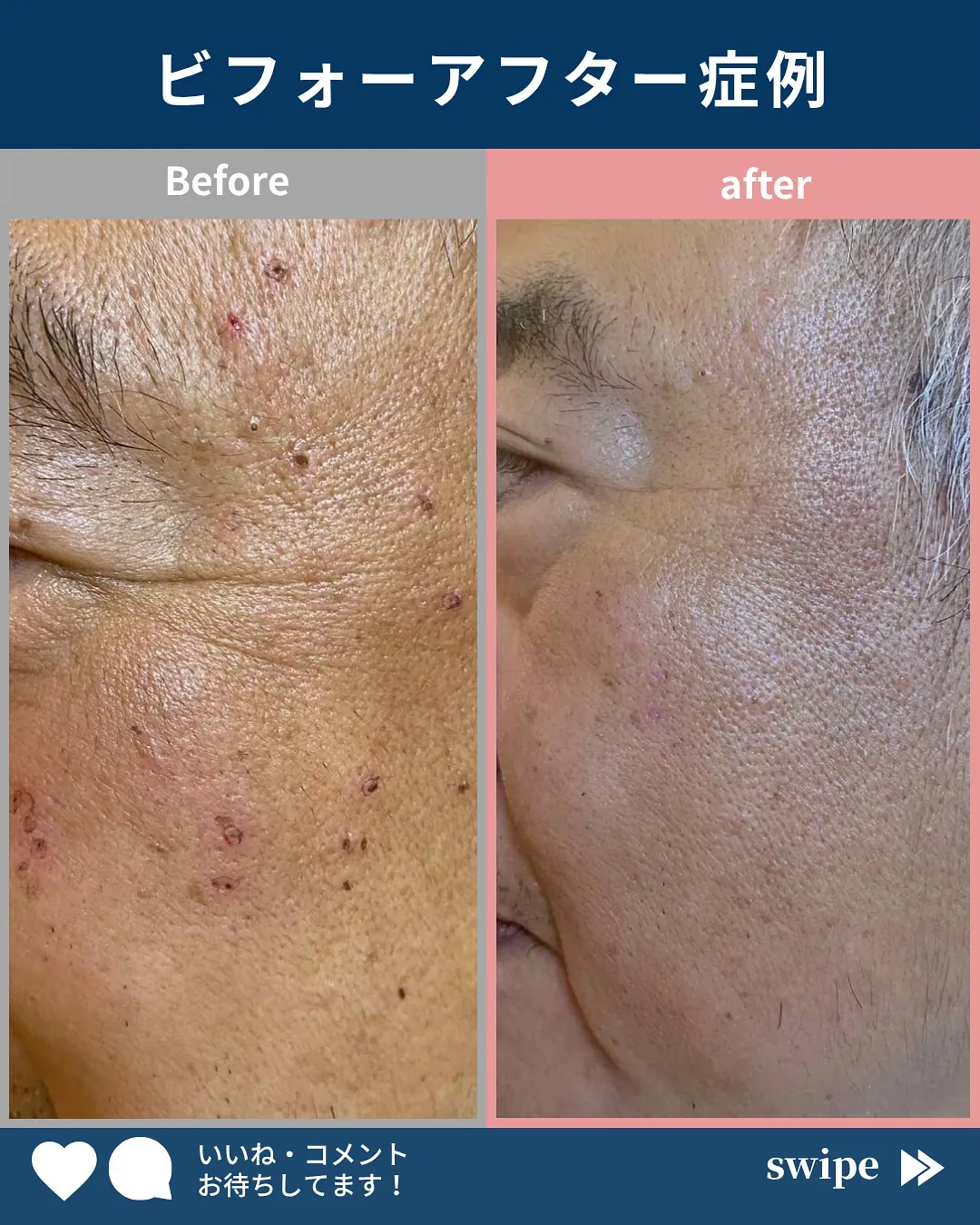 ←施術の詳細はこちらから！