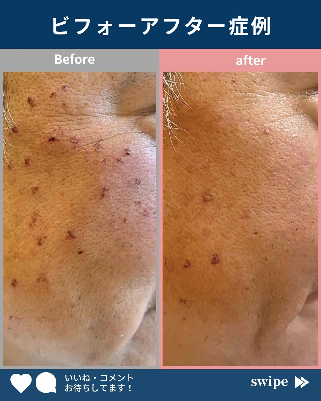 ←施術の詳細はこちらから！