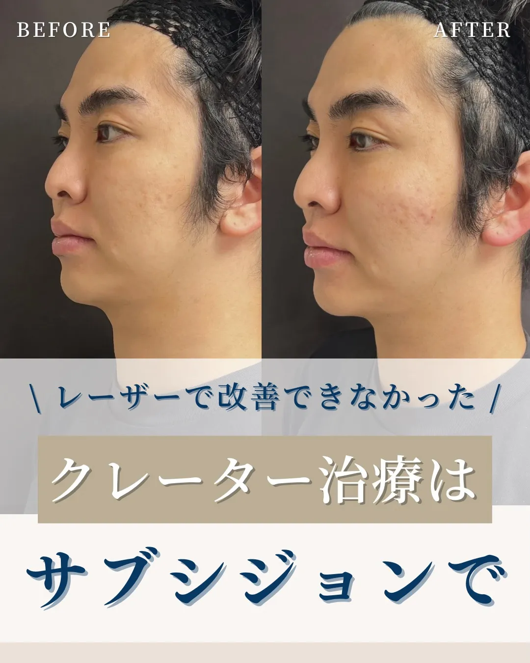 ←施術の詳細はこちらから!