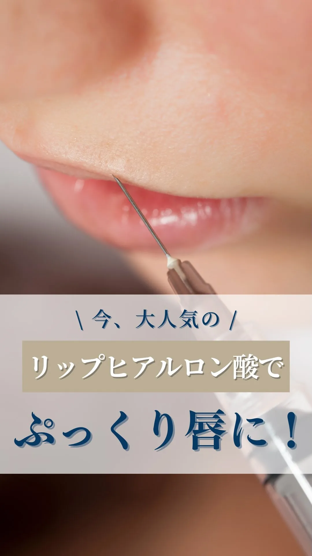 ←施術の詳細はこちらから！