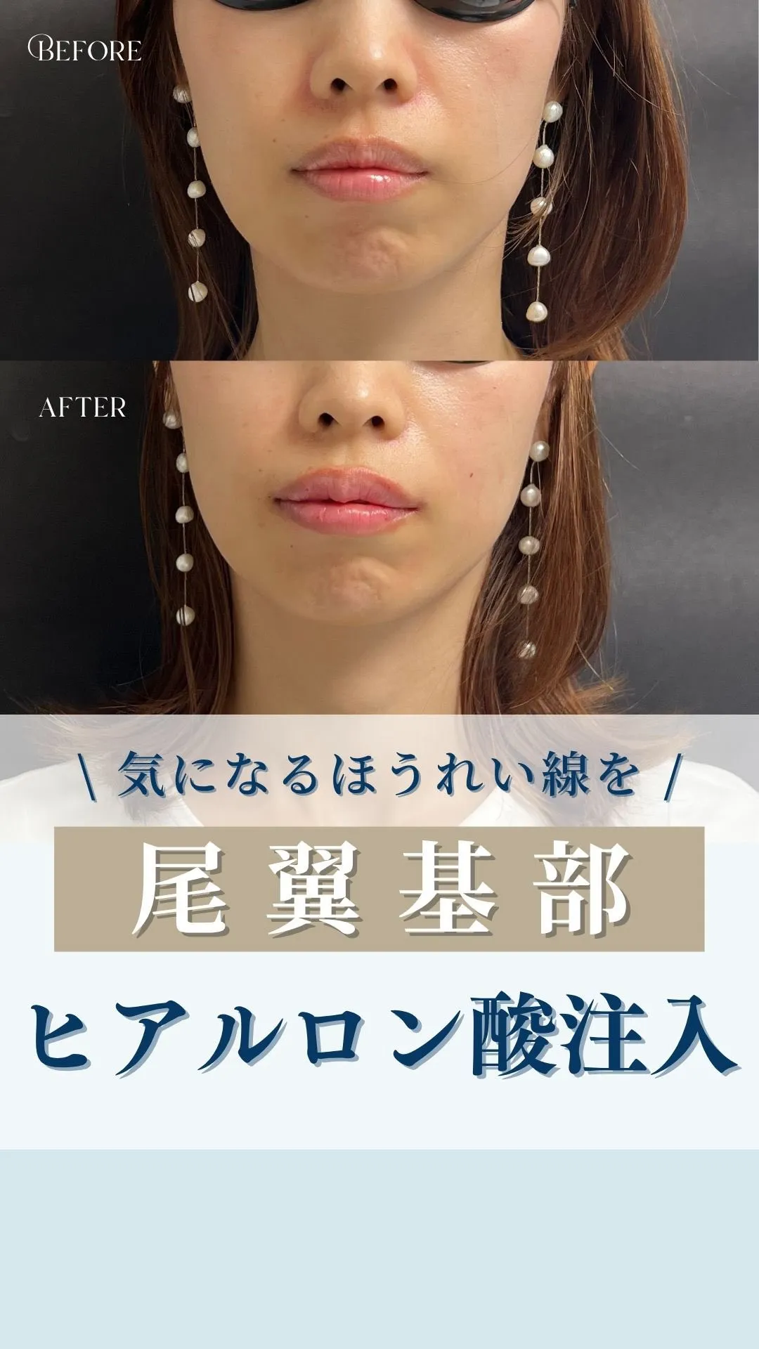 ←施術の詳細はこちらから！