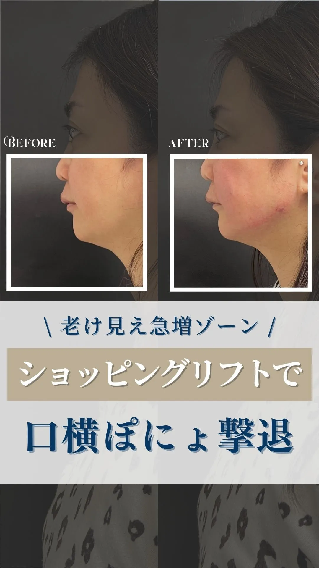 ←施術の詳細はこちらから！