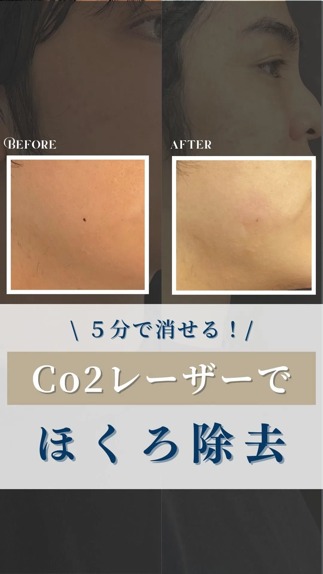 ←施術の詳細はこちらから！