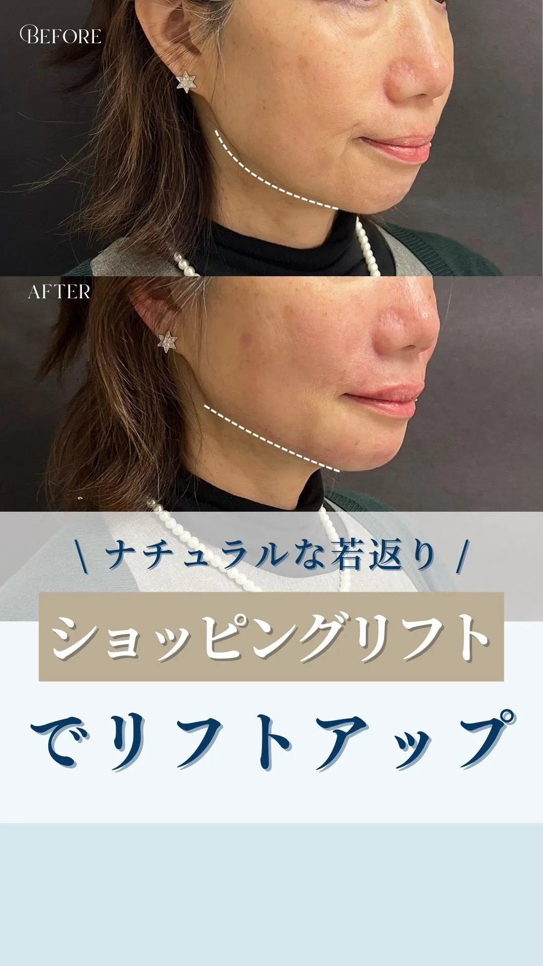 ←施術の詳細はこちらから！