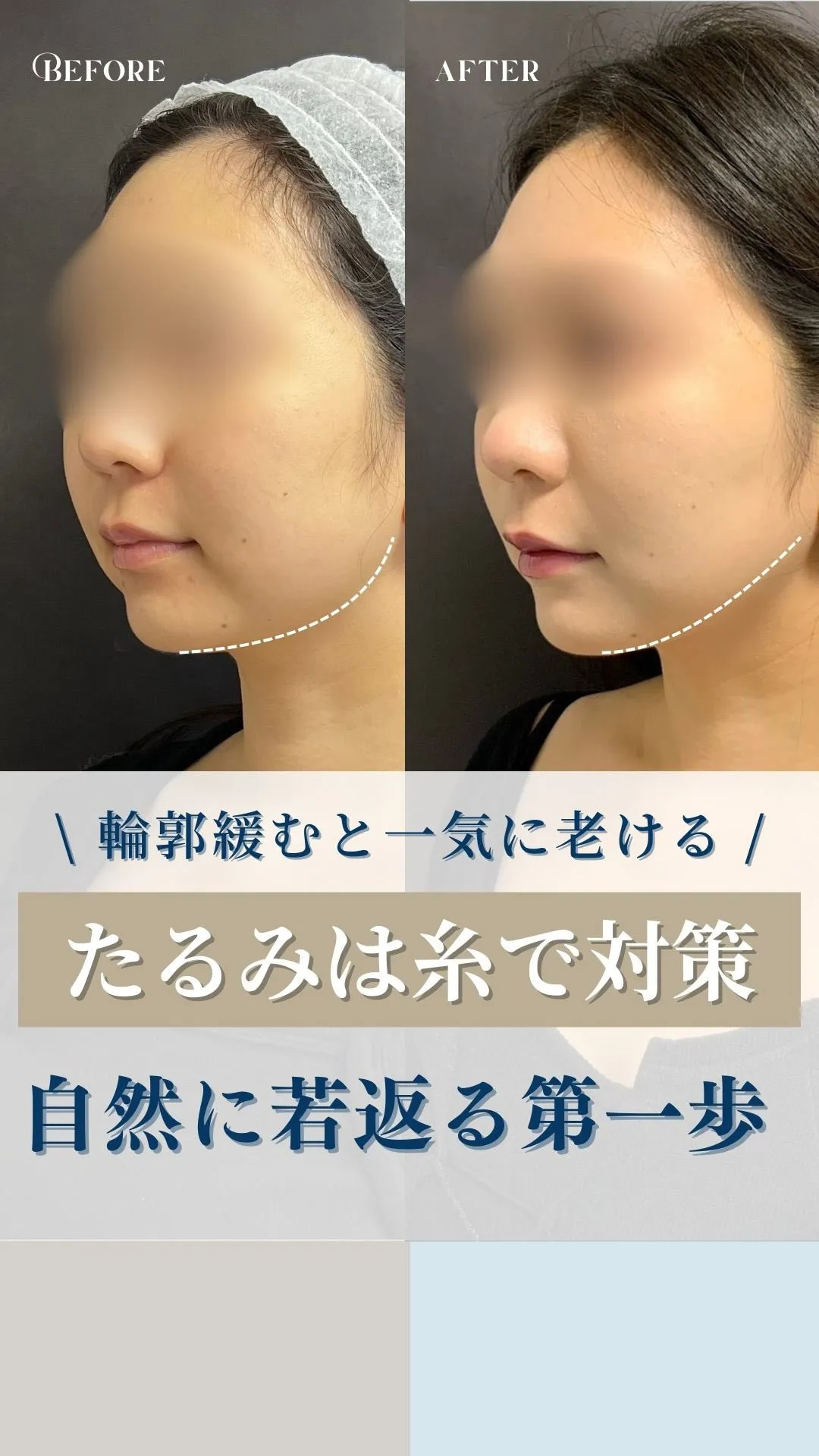 ←施術の詳細はこちらから！